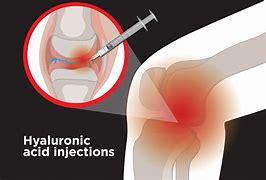 Read more about the article Why we should inject HA? Why steroid injection is bad for our body/joints?